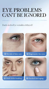 Caviar Eye Bag Removal Cream Hyaluronic Acid Anti-Wrinkle Firming Skin Fade Fine Lines Anti Dark Circle Puffiness Eye Care 20g
