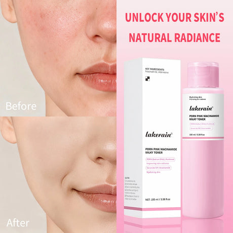 PDRN Pink Niacinamide Milky Toner for Hydrating Moisturizing Soothing Ceramide Glass Glow Skin Milky Toner Korean Skincare