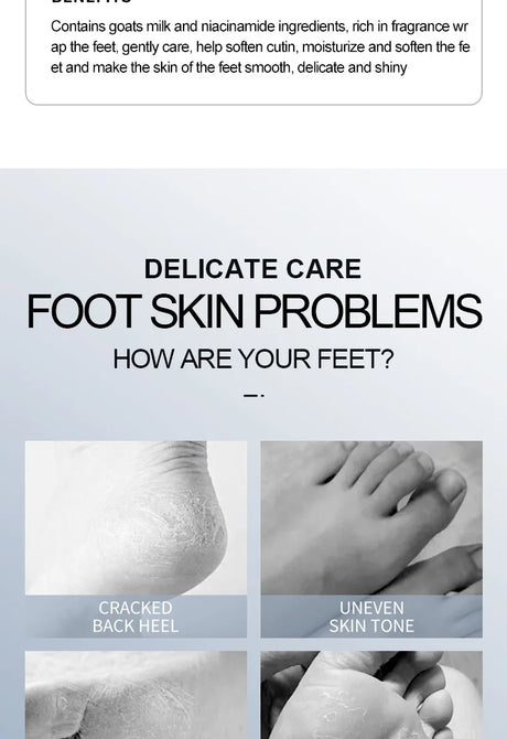 SADOER  Exfoliating Feet Mask Exfoliating Foot Peel Mask Socks Pedicure Peeling Dead Skin Remover Feet Mask Peel Moisturizing