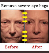 9selling wrinkle removing eye cream, eye bags, dark circles, anti swelling, firming, brightening, fine lines, moisturizing tool