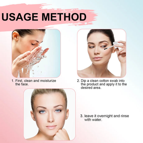 Salicylic Acid Facial Moisturizing Lotion Shrink Pores Nourishing Damaged Skin Treatment Acne Remove Spot Whitening Face Essence