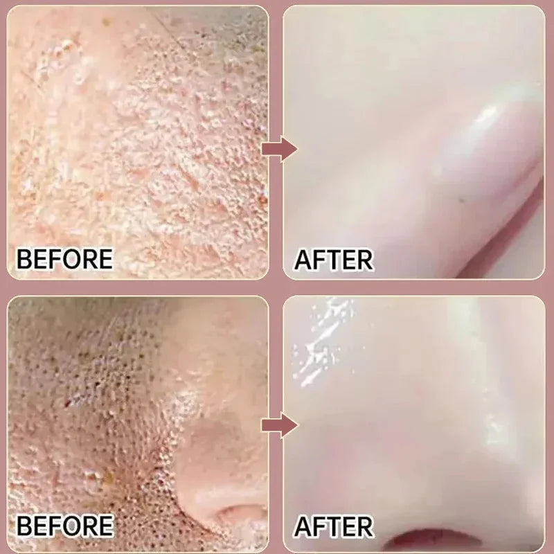 Remove Large Pores Serum Salicylic Acid Facial Pore Shrinking Tightening Pore Minimizing Firming Smooth Essence Korean Skin Care