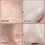 Remove Large Pores Serum Salicylic Acid Facial Pore Shrinking Tightening Pore Minimizing Firming Smooth Essence Korean Skin Care