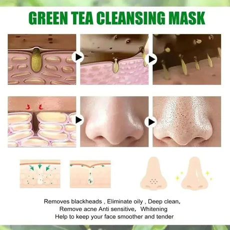 Original Facial Remove Blackhead Green Tea Solid Mask Treat Acne Blemish Black Dots Clean Stick Cream Shrink Pores Skin Care
