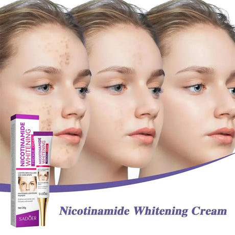 SADOER Nicotinamide Remove Melasma Dark Spot Whiten Freckle Cream Lighten Melanin Brightens Skin Tone Moisturize Face Skin Care