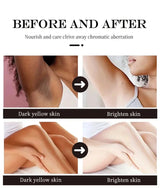 Whitening Cream Private Parts Underarm Bleaching Serum Whiten Butt Knee Brighten Inner Thigh Intimate Parts Dark Remove Melanin