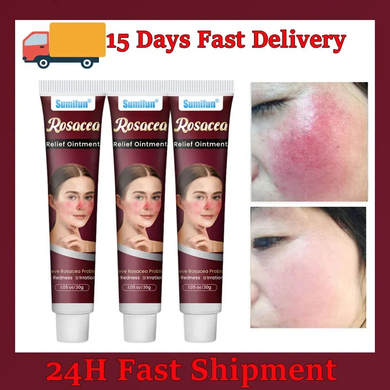 Repair Facial Redness Cream Instant Spider Vein Remove Sensitive Skin Sooth Anti Redness Rosacea Treat Lotion Korean Cosmetics
