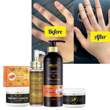 AILKE Collagen Whitening Set, Moisturizer, Hydration, Dark Spot Removal, Brightening Body Lotion, Armpit Whitening Cream