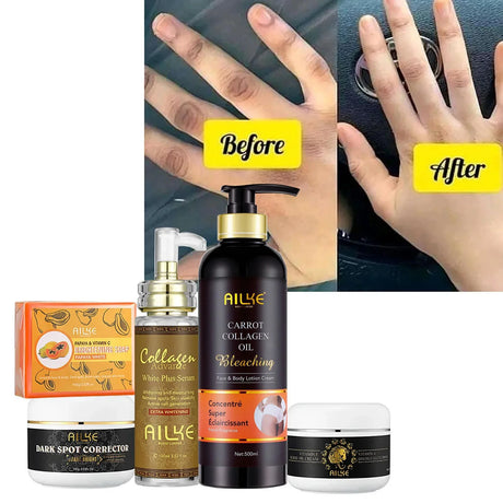AILKE Collagen Whitening Set, Moisturizer, Hydration, Dark Spot Removal, Brightening Body Lotion, Armpit Whitening Cream