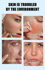 Face Serum Fruit Acid Acne Treatment Oil Control Remove Blackheads Shrink Pores Skin Texture Improve Care