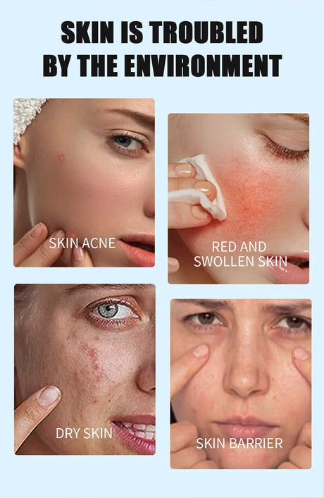 Face Serum Fruit Acid Acne Treatment Oil Control Remove Blackheads Shrink Pores Skin Texture Improve Care
