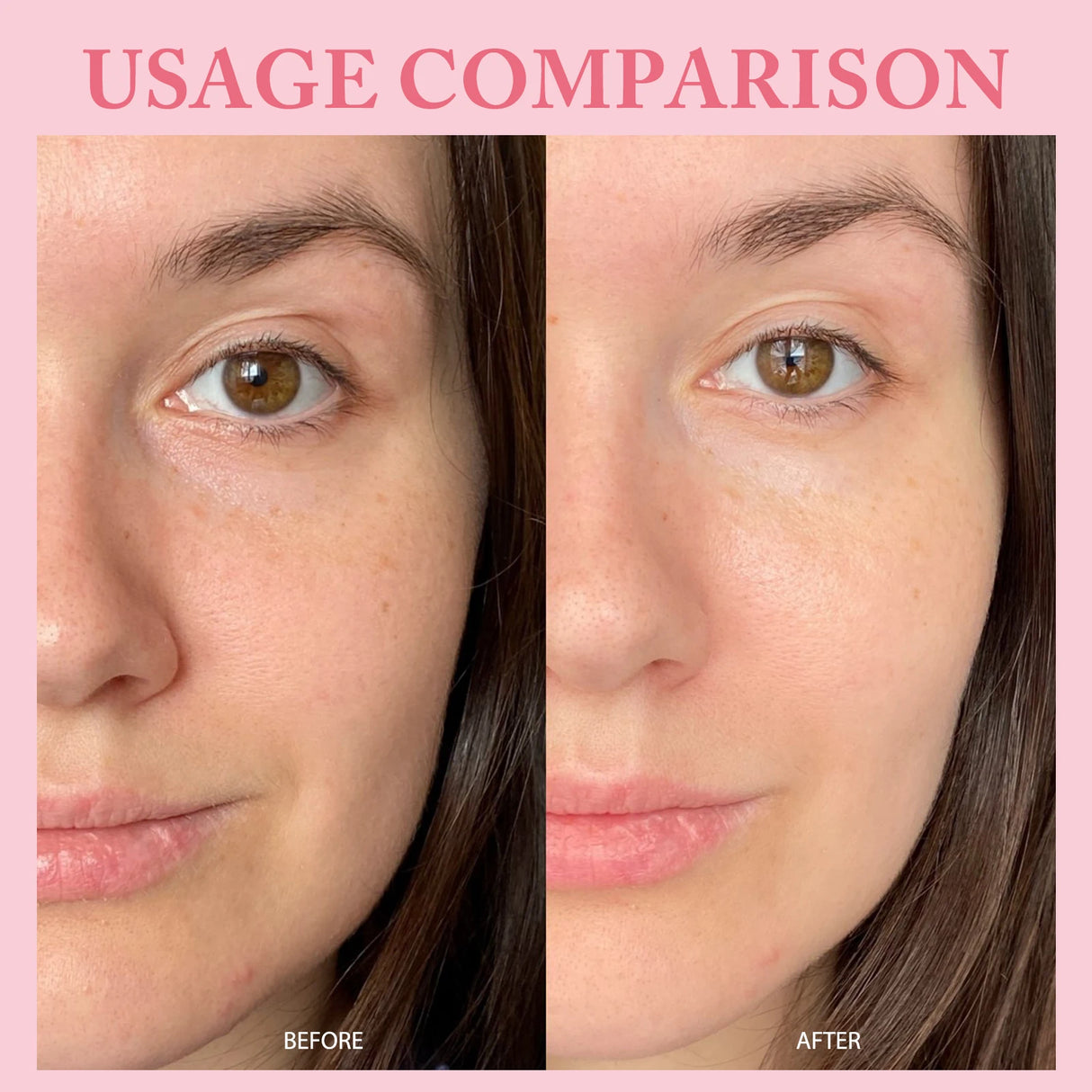 10pcs/Box PDRN Serum Moisturizing Repairs Brightens Reduces Sagging Skin Care Essence Benefits Anti Aging Facial Treatment