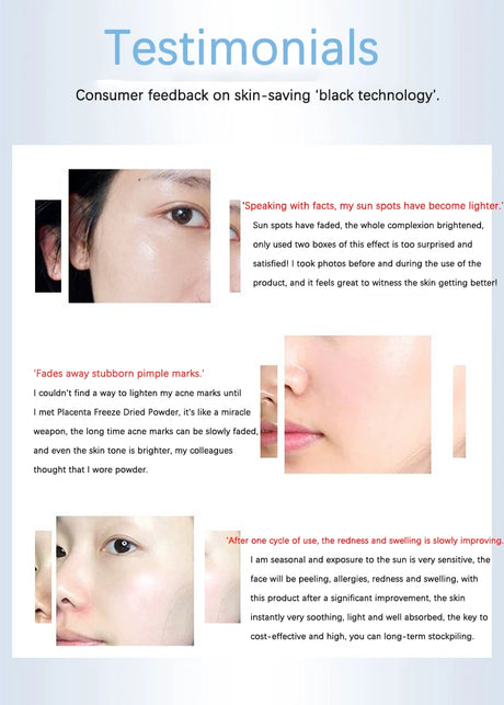 Oligopeptide Placenta Freeze-dried Powder Essence Repair Facial Moisturiz Hydrating Pore Shrinkage Skin Rejuvenation Skin Care