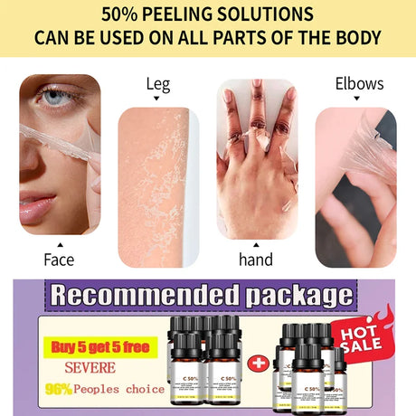 High Quality 50% Chemical Peel Acid Skin Superforce Pigmentation Lightening Melanin Acne Treatment Remove Scar