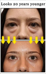 9selling wrinkle removing eye cream, eye bags, dark circles, anti swelling, firming, brightening, fine lines, moisturizing tool
