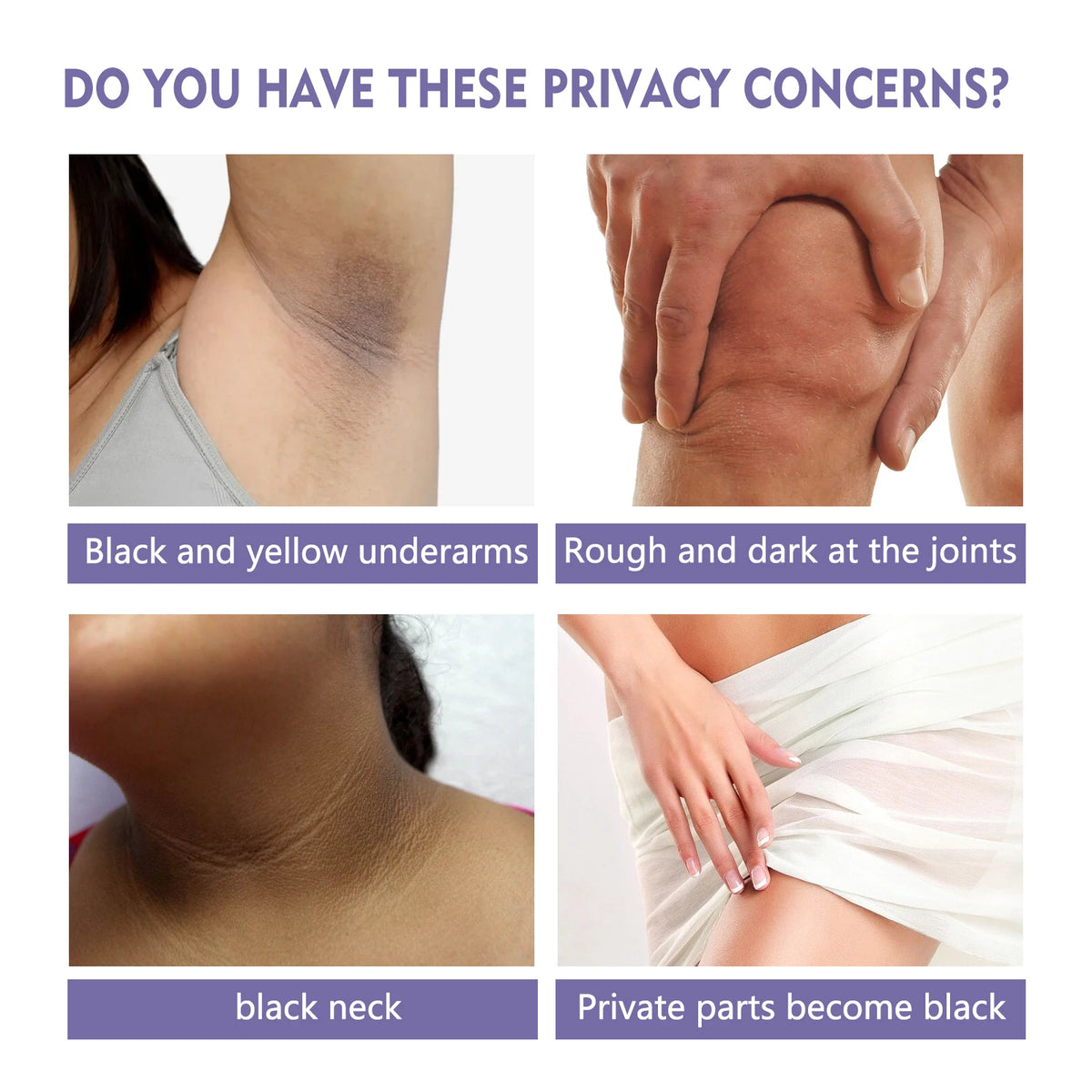 Armpit Brightening Cream Private Parts Dark Skin Bleaching Cream Lighten Melanin Knee Underarm Nipple Soften Dark Body Skin Care