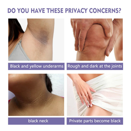 Armpit Brightening Cream Private Parts Dark Skin Bleaching Cream Lighten Melanin Knee Underarm Nipple Soften Dark Body Skin Care
