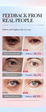 Instant Eye Bag Remove Cream Retinol Anti-Wrinkle Firming Skin Fade Fine Lines Anti Dark Circle Puffiness Brighten Eye SkinCare