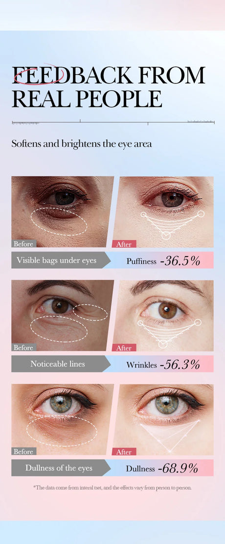 Instant Eye Bag Remove Cream Retinol Anti-Wrinkle Firming Skin Fade Fine Lines Anti Dark Circle Puffiness Brighten Eye SkinCare