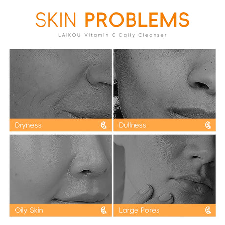 LAIKOU Vitamin C Daily Cleanser Brightening Face Wash Deep Cleansing Moisturizing Skin Tone Even Treatment