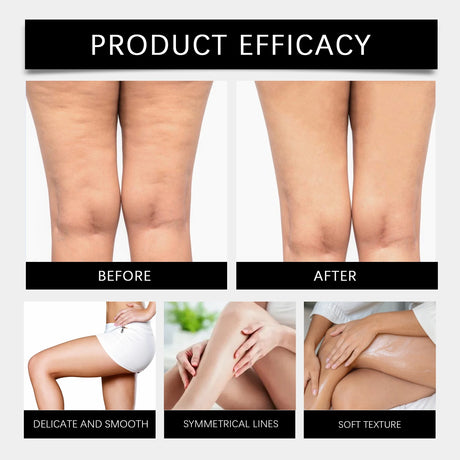 Inner Thigh Firming Cream Tightening Improve Sagging Skin Lifting Firming Buttocks Body Contouring Reduces Cellulite Appearance