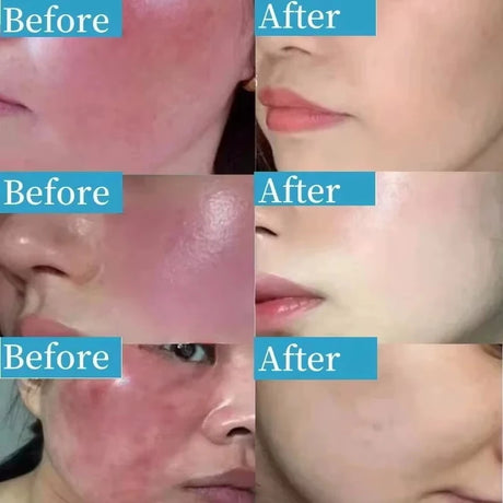 B5 Repair Cream Moisturizing Hydrating Effectively Solves Dry Chapped And Red Skin Nourishes Improve Repair Sunscreen Cream