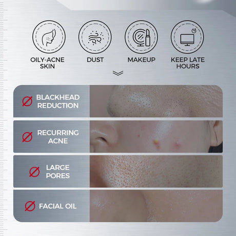 NING DERMOLOGIE Amino Acid Korean Facial Cleanser with Salicylic Acid Help with Pore Tighten, Acne & Blackheads