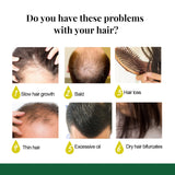 Ginger Care Hair Spray Hair Growth Essence Nourish Hair Roots Massag Scalp Repair Hair Quality Control Oil Hair Care Solution