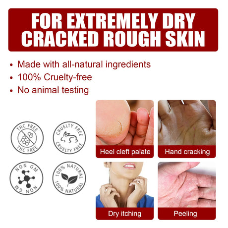 Exfoliating Feet Mask Sock Exfoliation Scrub for Feet Mask Remove Dead Skin Moisturizing Pedicure Anti Crack Foot Patch Spa 5PCS