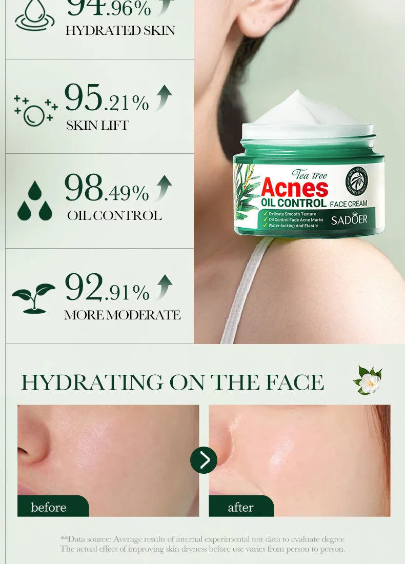 SADOER Tea Tree Acne Removing Face Cream Anti Acne Hydrating Oil Control Moisturizing Facial Creams Face Skin Care Products