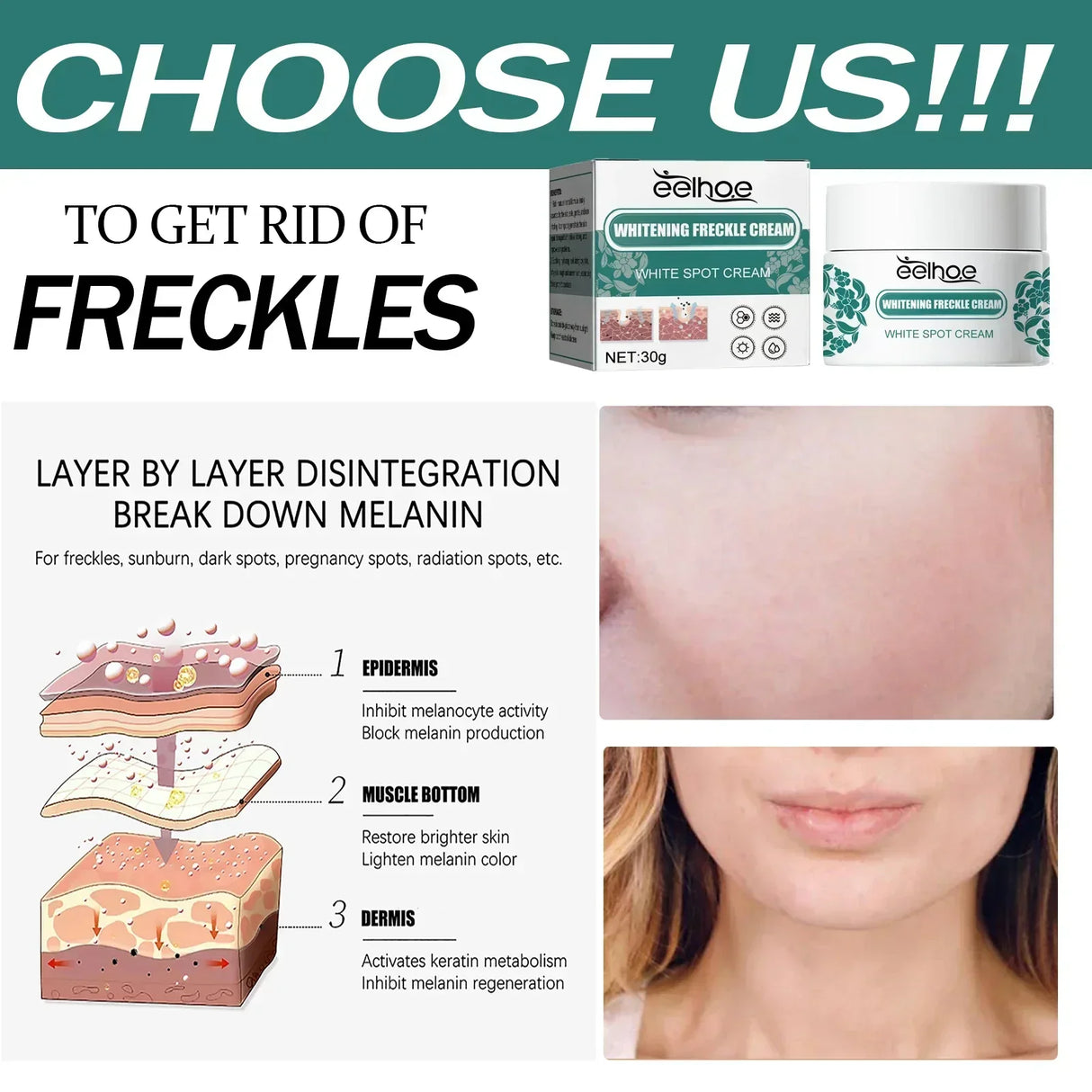 Whitening Freckle Cream Effectively reduces dark spots Brightens and revitalizes dull skin  Hydrates and nourishes the skin