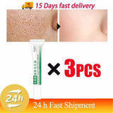 Salicylic Acid Pore Shrinking Cream Quick Elimination Large Pores Remove Blackehead Tighten Face Smooth Skin Korean Care Product