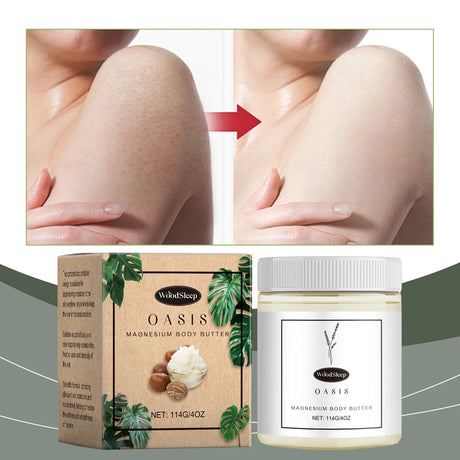 Shea Butter Body Lotion Moisturizing Magnesium Body Butter Nourishing Skin Soft Smooth Soothes Muscles Body Skincare Cream