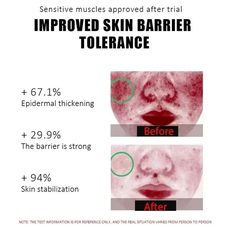 B5 Repair Facial Redness Cream Instant Spider Vein Remove Sensitive Skin Sooth Anti Redness Rosacea Treat Lotion Korean Cosmetic