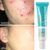 Salicylic Acid Acne Treatment Cream Repair Pimple Spots Deep Cleaning Pore Shrinking Anti-acne Oil Control Moisturizer Skin Care