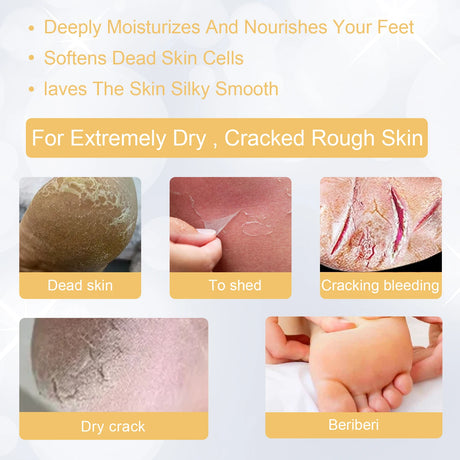 Ouhoe Foot Exfoliating Spray 72H Moisture Lock Callus Softener Anti Dry Crack Repair Odor Control Brightening Foot Care Liquid