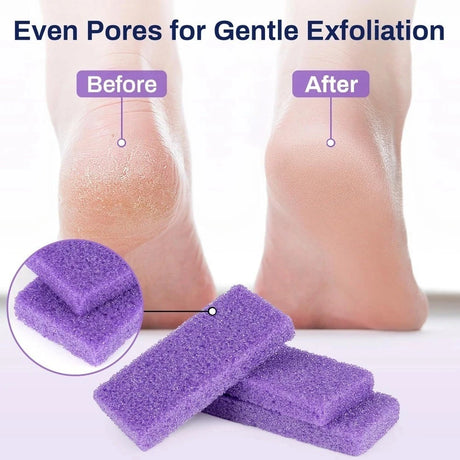 Premium Foot Care Set – Dual-Sided Foot File & Natural Pumice Stone for Smooth, Soft Heels