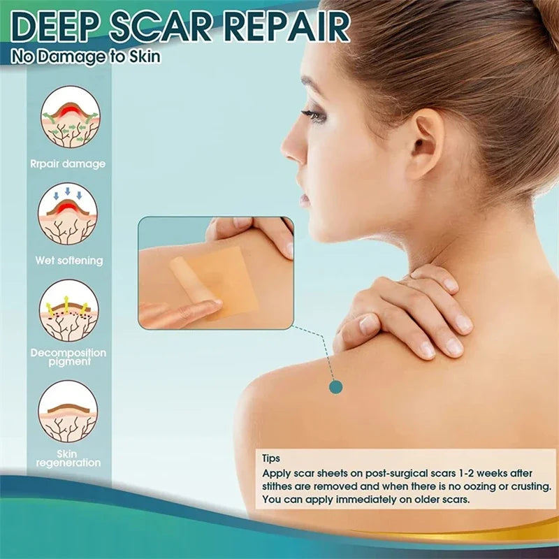 Silicone Scar Sheets - Reusable Scar Tape for Keloid, C-Section, Surgery, Burn, Acne - Waterproof, Hypoallergenic, Latex-Free