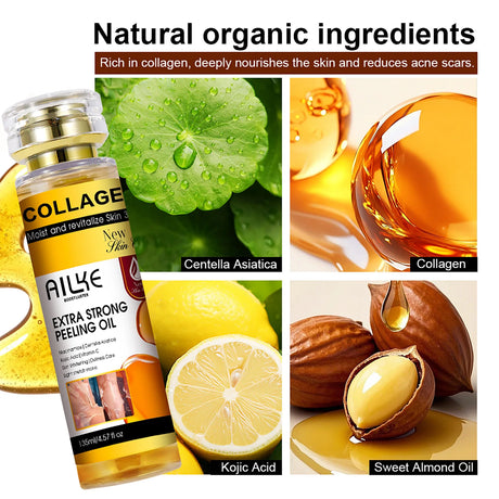 AILKE Collagen Yellow Peeling Oil For All Skin Types, Stretch Mark Removal, Lightening , Improve Rough Skin, Gentle Exfoliation
