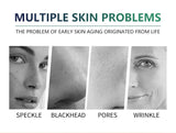 High Quality 50% Chemical Peel Acid Skin Superforce Pigmentation Lightening Melanin Acne Treatment Remove Scar