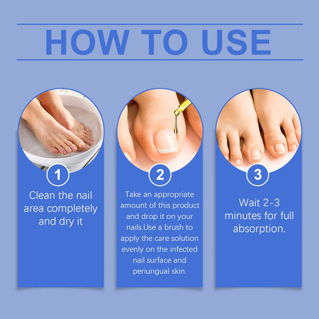 Nail Fungus Care Solution Anti-Infection Onychomycosis Repair Damaged Cracked Hand Foot Nail Manicureed Health Care Essence 50ml