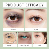 Hyaluronic Acid Eye Mask Under Eye Mask Anti Dark Circles Remove Eye Bags Improves Dullness Moisturizing Hydrating Eye Patches