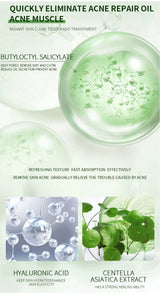Anti-Acne Cream Effectively Removes Skin Nodules Pustules Cysts Papules Blackheads Men And Women Acne Skin Care Essence Cream