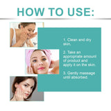 Powerful Spot-removing Whitening Freckles Cream Remove Melasma Dark Spots Fade Pigmentation Acne Moisturizing Brighten Skin Care