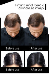 SEVICH Hair Fiber 100g Keratin Hair Fiber Thickening powder Hair Building Fiber Spray Instant Regrowth Powder Hair Loss Conceale