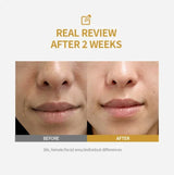Silk Peptide Intensive Lifting Ampoule |Anti-Aging Serum For Face With Collagen & 30 Peptide Complex  Skin Tightening & Firming