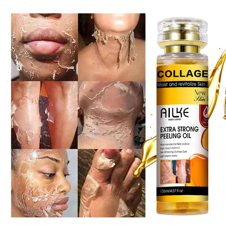 AILKE Collagen Extra Strong Peeling Oil, Whitening Skin, Exfoliating Solution for Face, Body, Hand, Feet, for All Skin Types