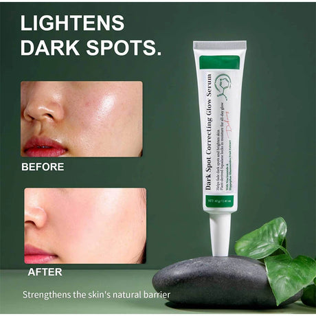 Dark Spot Correcting Glow Serum,Dullness,Acne,And Melanin Remover,Niacinamide Facial Skin Moisturizing Brightening Skincare