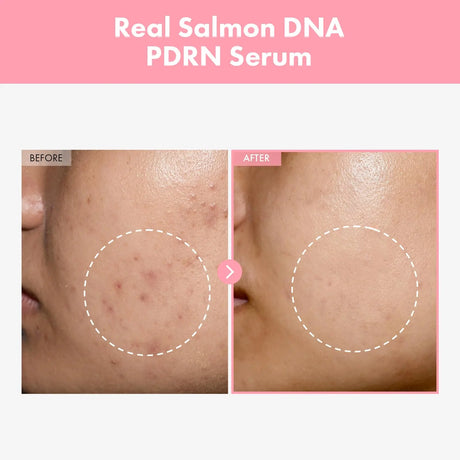Facial care E-s-s-e-n-c-e Delicate and moisturizing Skin. Pink Peptide Hydrolyzed Collagen pdrn E-s-s-e-n-c-e