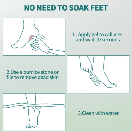 NAILPOP Foot Care Callus Softener Combo Callus Remover Gel & Foot File Set For Dry Rough Cracked Heel - Feet Exfoliator Scrubber